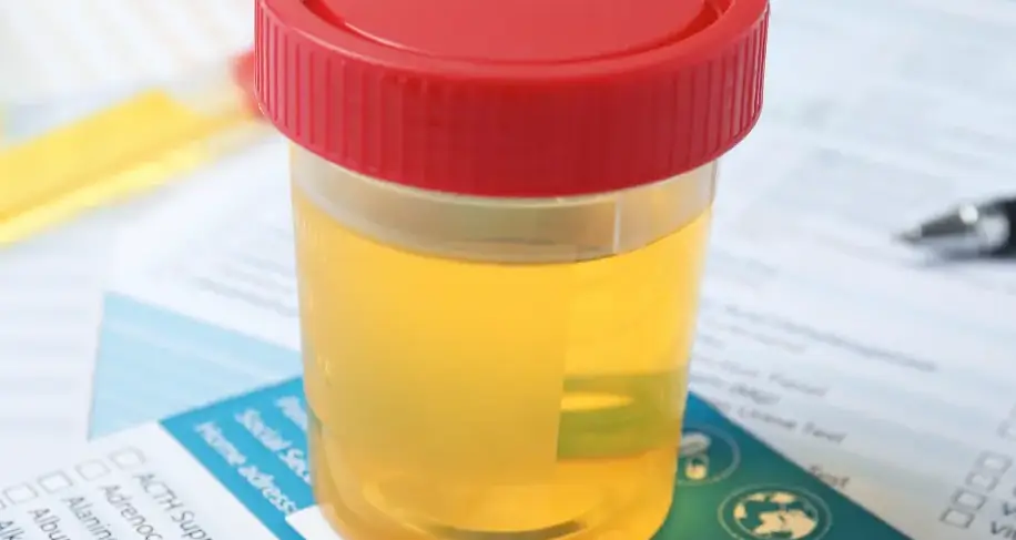 Does THCa Show Up on a Drug Test? @ HighHippy.com Blogs